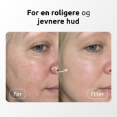 Élara LED Light Therapy Mask Élara LED Light Therapy Mask